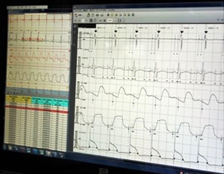 心臓電気生理学解析システム